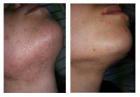 LaserWise Skin & Beauty Clinic image 12